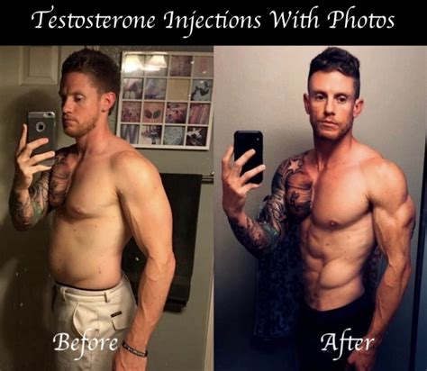 After you lose that weight, your genitals have the space they need to fully show themselves. . Testosterone injections before and after photos